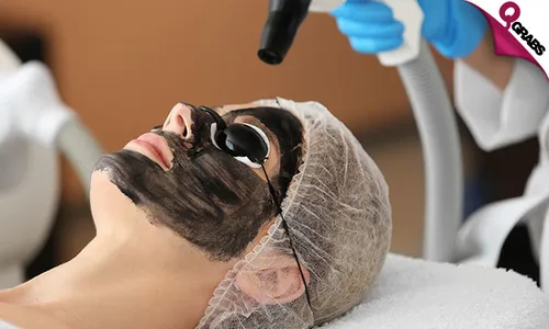 Spectra Carbon Laser Treatments for Ladies & Men!